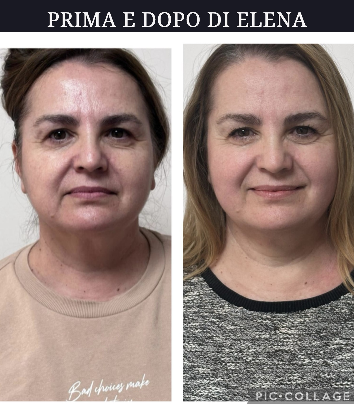 Risultato autentico Face Yoga di Elena