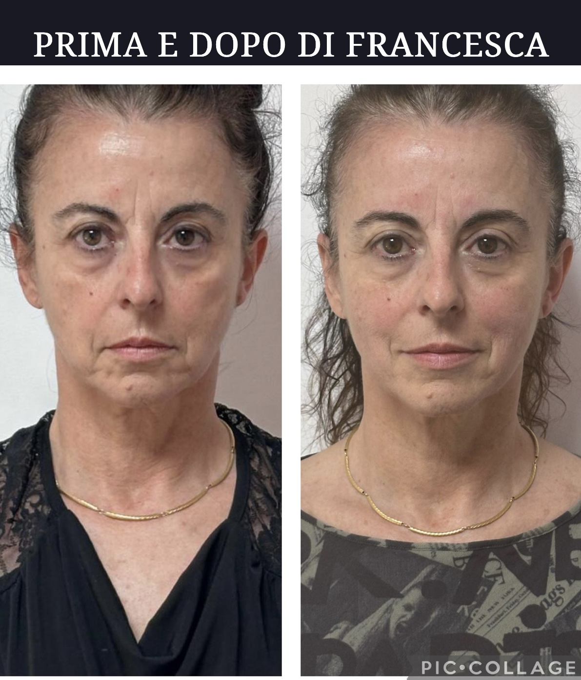 Risultato autentico Face Yoga di Francesca