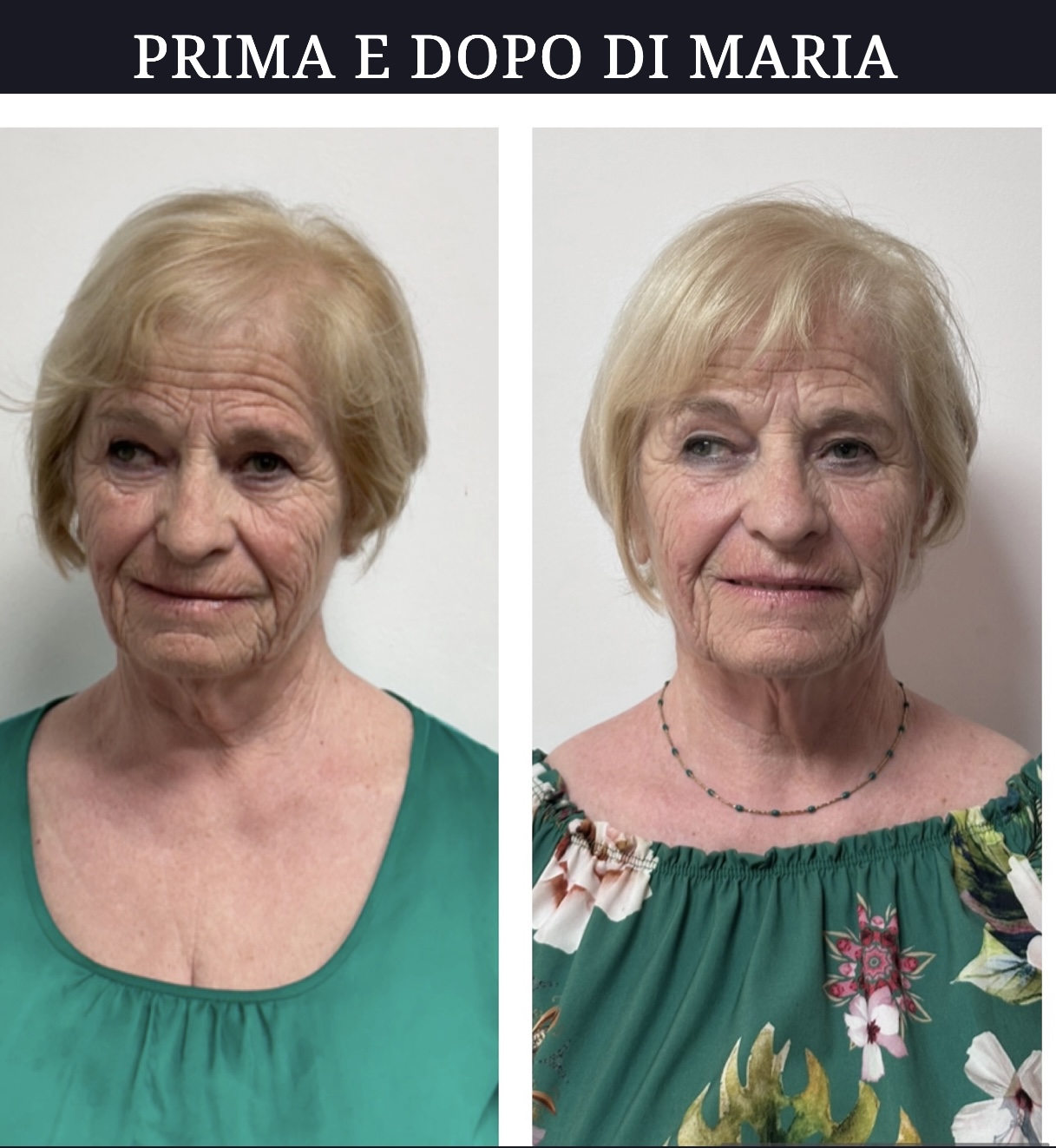 Risultato autentico Face Yoga di Maria